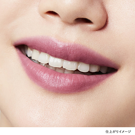 ルージュスターブリーズ B104 詳細画像 5枚中2枚目